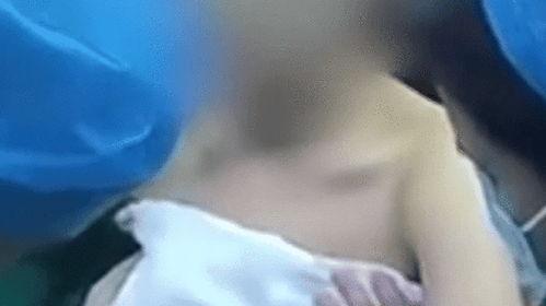 隆胸全程视频